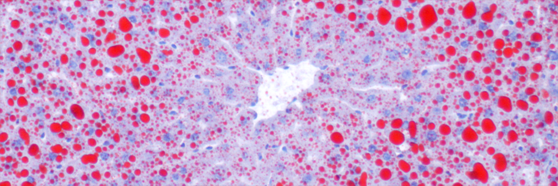 Liver - Oil Red O stain for lipids