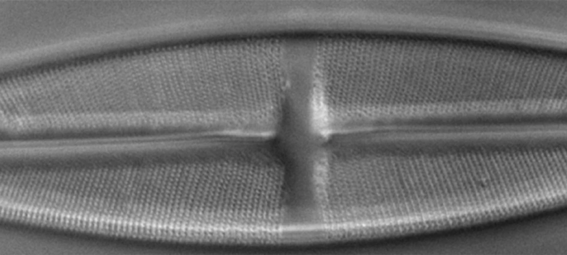 Diatome by Differential Interference Microscopy