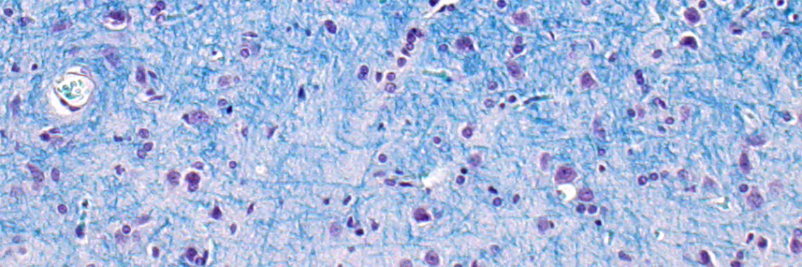 brightfield color microscope image Luxol fast blue stain