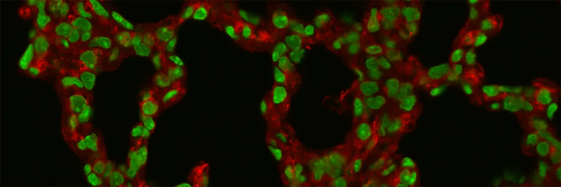 Confocal microscope image
