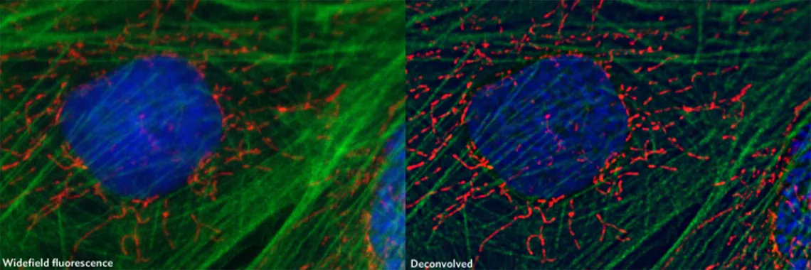 Widefield and deconvolved image of fluorescently labeled fibroblasts