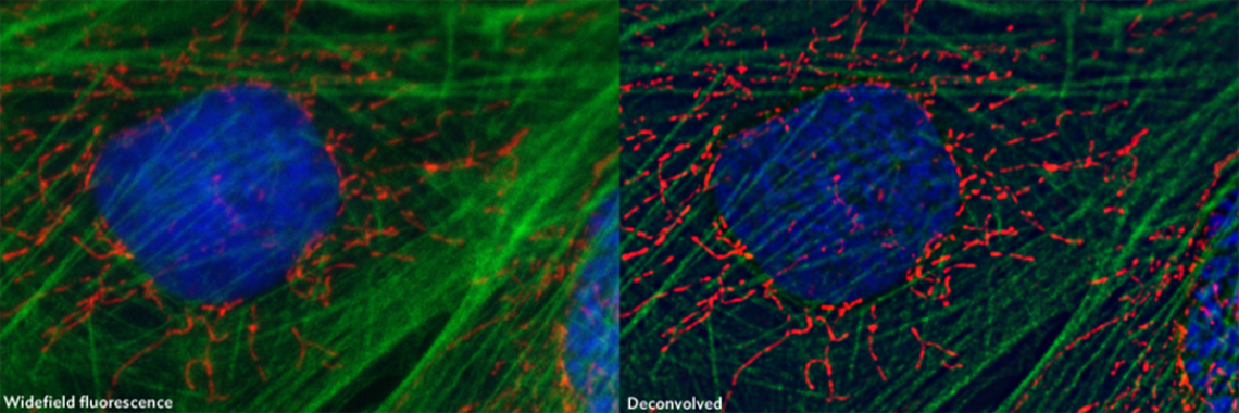 Widefield and deconvolved image of fluorescently labeled fibroblasts