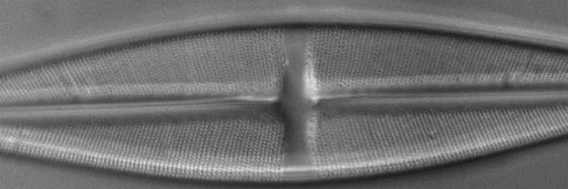 Diatome by Differential Interference Microscopy