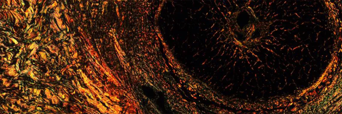 Polarized light microscopy image